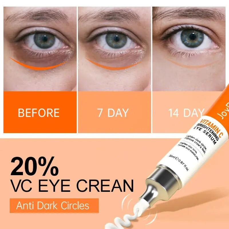 Eye Cream Anti Dark Circles Eye Bag